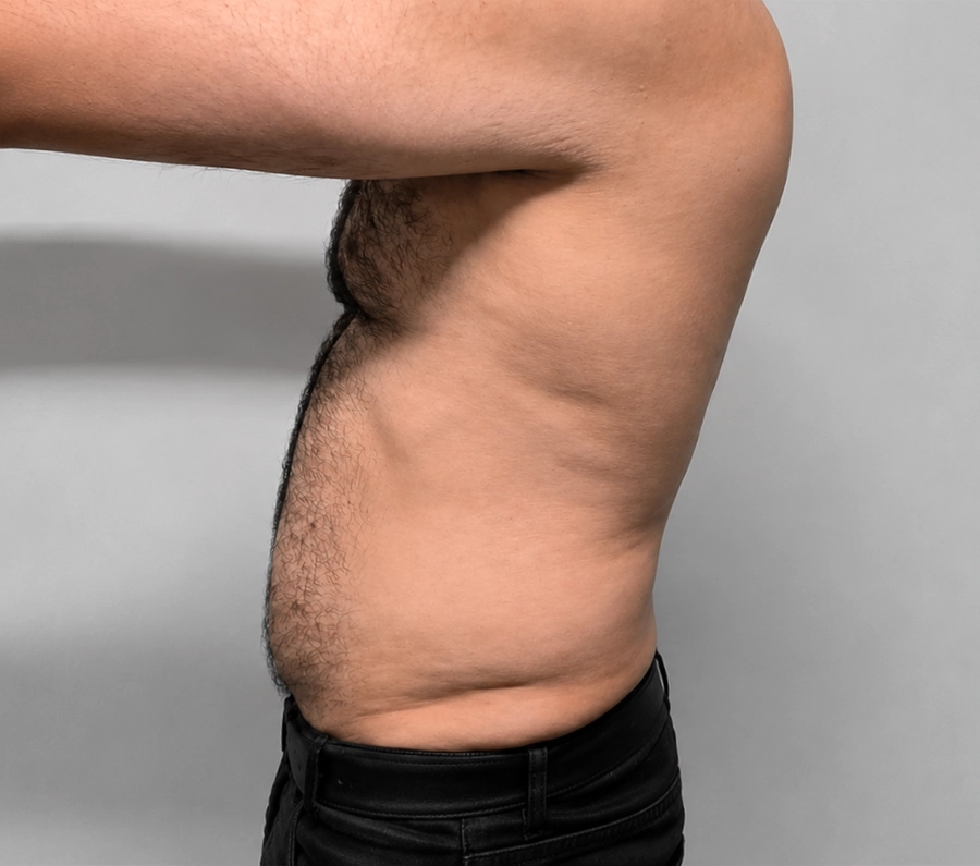 نمونه کار لاغری دستگاه اوندا